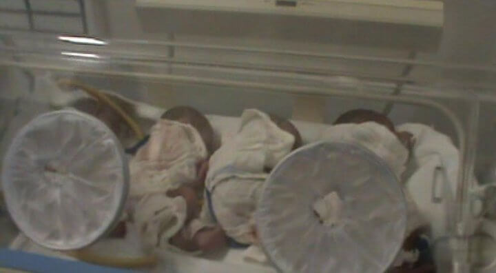 Quadrigêmeos na incubadora para ganhar peso (Foto: Facebook/ Alexandre Forti)