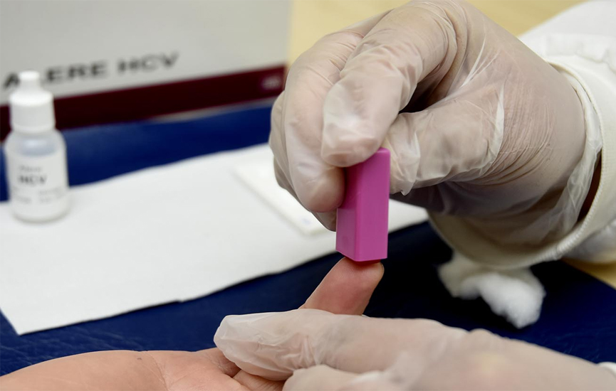Testes rápidos para hepatites estão disponíveis em todas as UBSs de Jundiaí