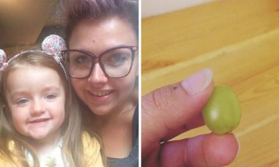 Mãe faz alerta após filha quase morrer engasgada com uva