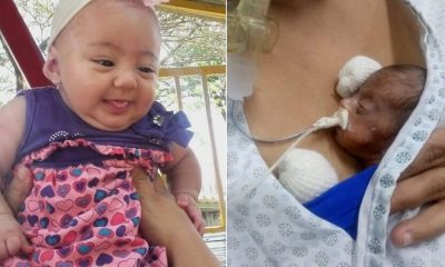 À esquerda, menina de sete meses com vestindo rosa sorrindo; à direita, bebê prematura sendo alimentada por sonda