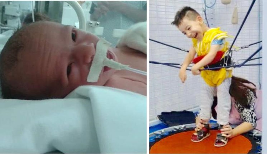 À esquerda, Fabrizio neném ainda entubado na maternidade; à direita, durante sessão de fisioterapia