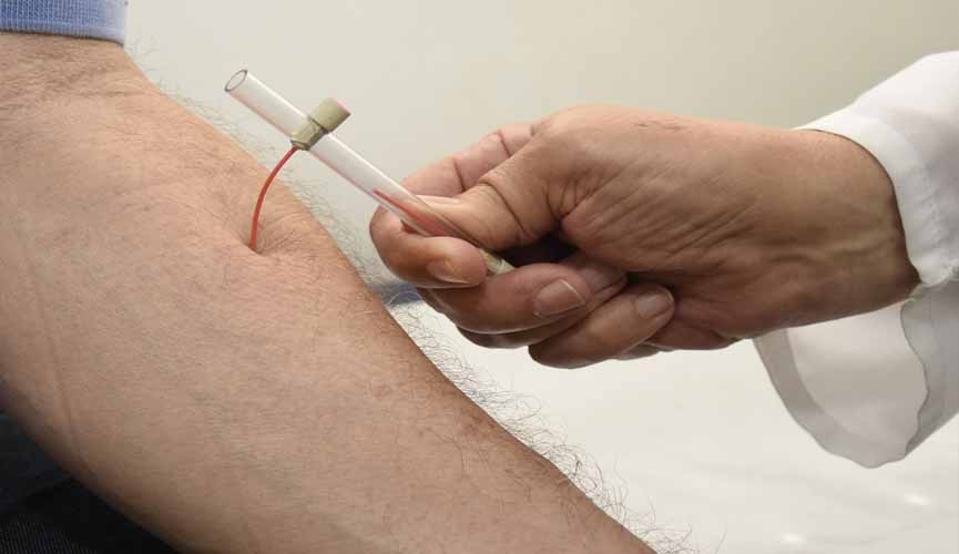 braço de homem sendo examinado por médico ,que com um tubo retira sangue