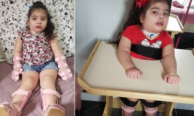 Criança com equipamento de mobilidade em cima de uma cama, à esquerda; mesma criança em cima de uma cadeira, à direita