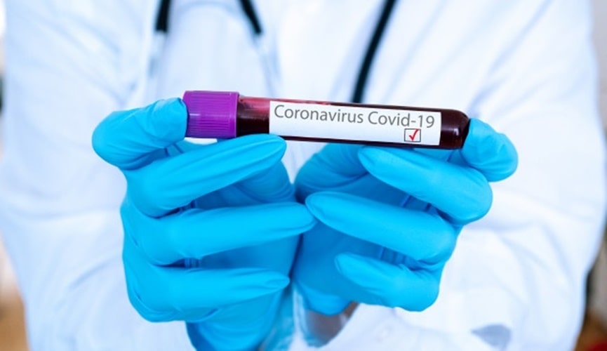 Foto de tubo de sangue com etiqueta de coronavírus