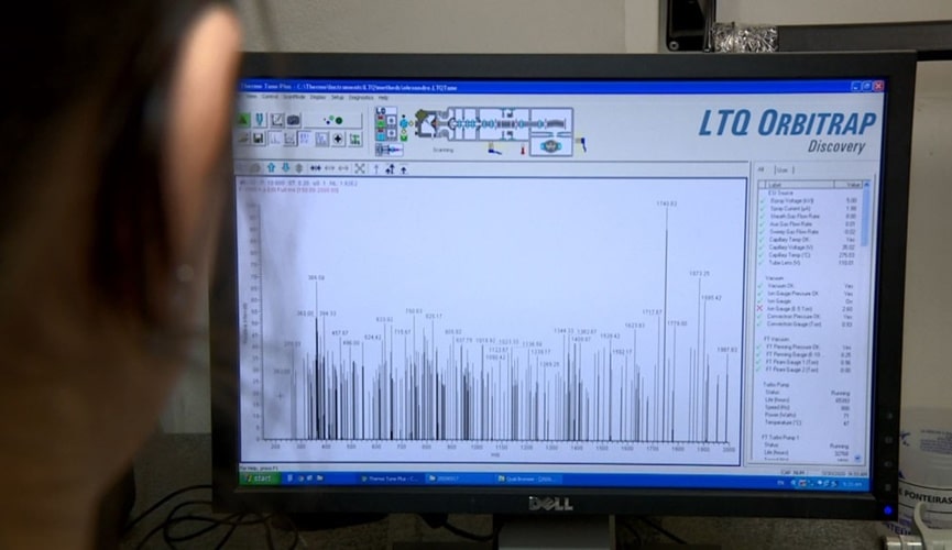 Foto de monitor apontando os biomarcadores citados no texto