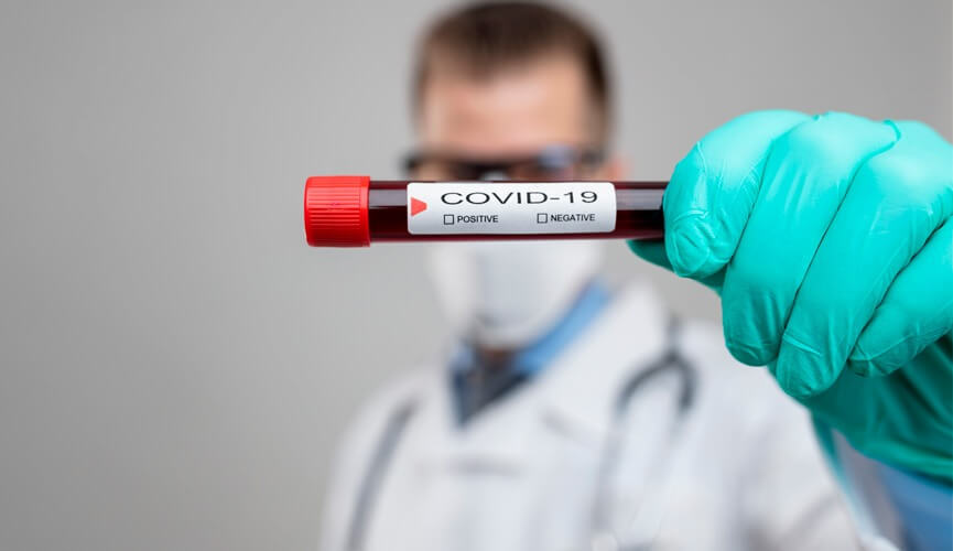 Médico segura tubo de ensaio com sangue e etiqueta de COVID-19