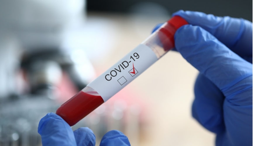 Foto de teste de coronavírus