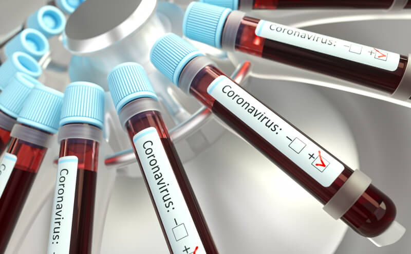 Tubo de análise de sangue com amostras de coronavírus