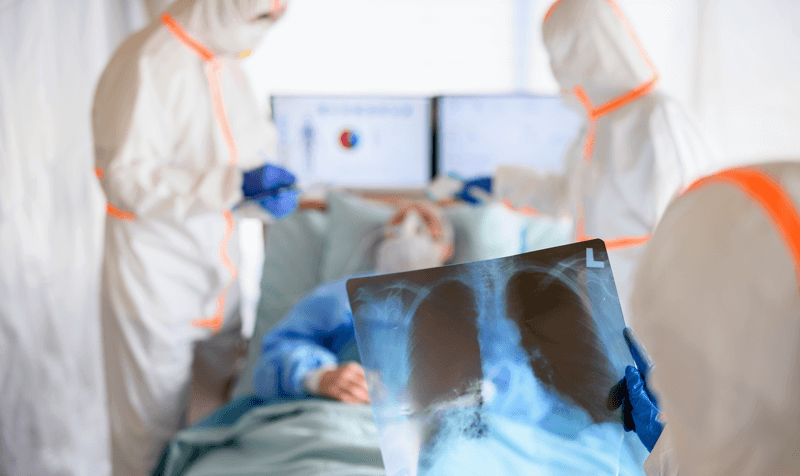 Médicos seguram chapa de raio x nas mãos em leito de UTI
