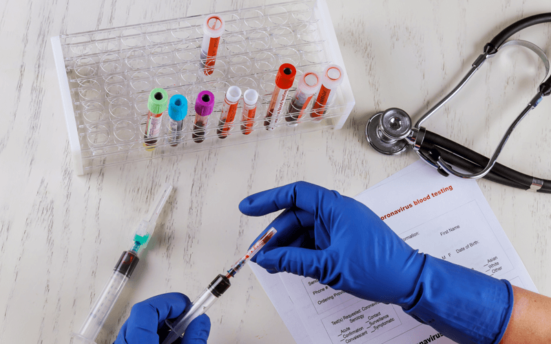 Tubos de sangue sendo analisados em laboratórios