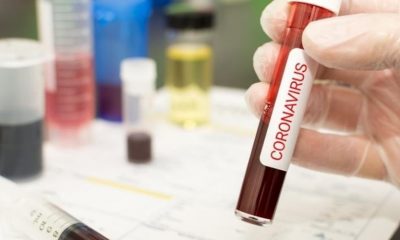 foto de tubo de ensaio com sangue