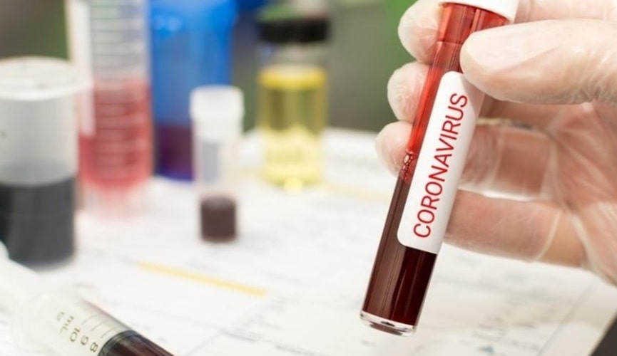 foto de tubo de ensaio com sangue