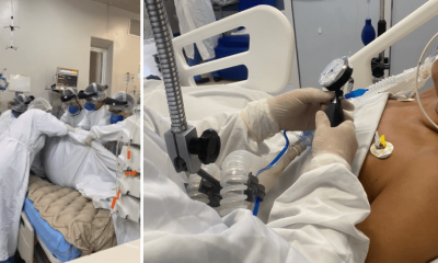 À esquerda, equipe faz pronação de paciente grave; à direita, fisioterapeuta mede capacidade respiratória