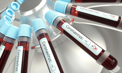 Tubos de sangue para análise de coronavírus