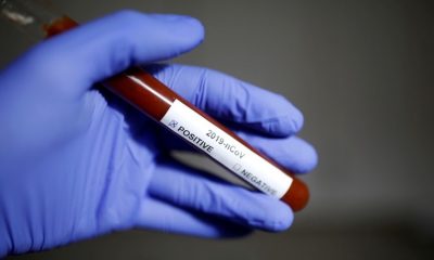 Foto de tubo de ensaio com sangue e etiqueta de identificação de Covid-19