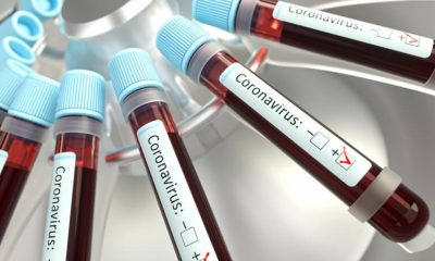 Tubos de laboratório com amostras de sangue com coronavírus