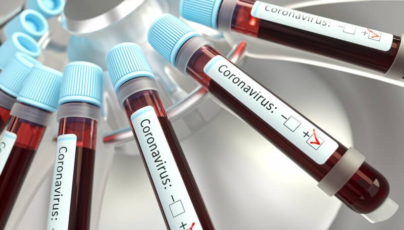 Tubos de laboratório com amostras de sangue com coronavírus