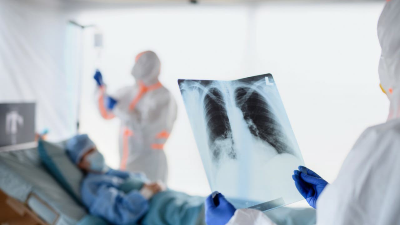 Médicos analisando raio-x pulmonar