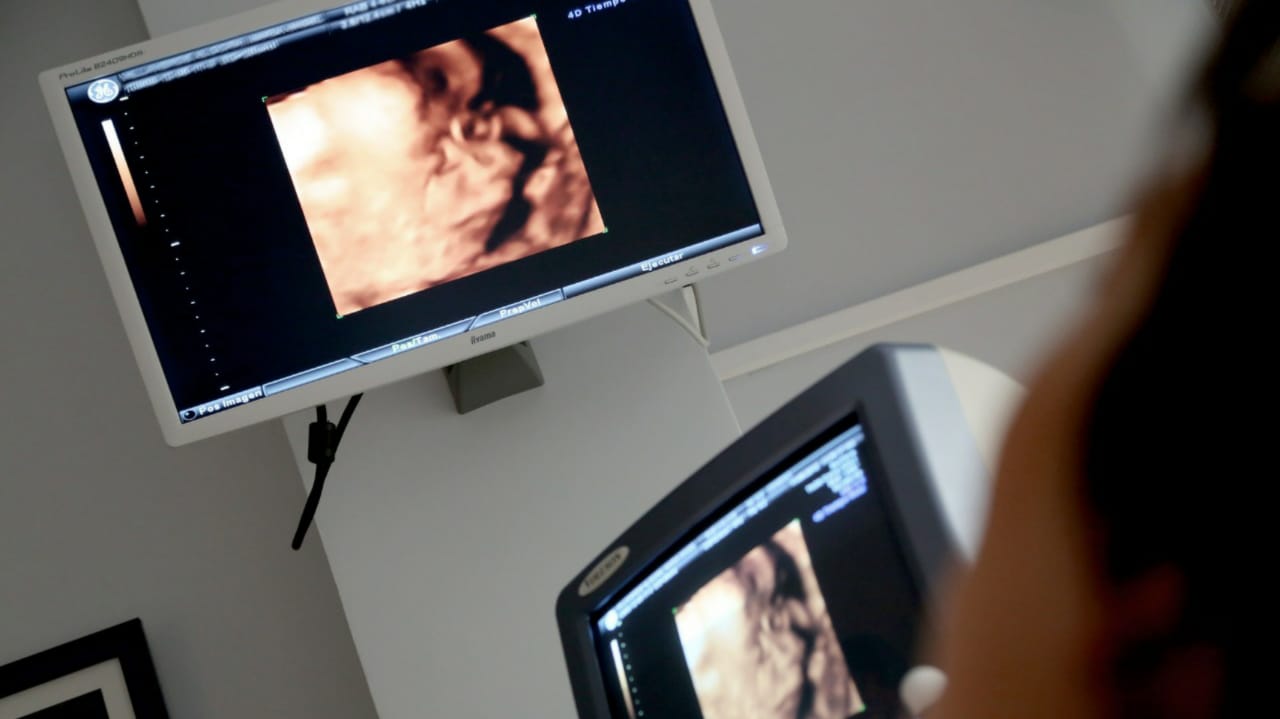 Imagem de ultrassonografia