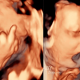 Ultrassom e bebê com o dedo do meio. (Foto: Divulgação)