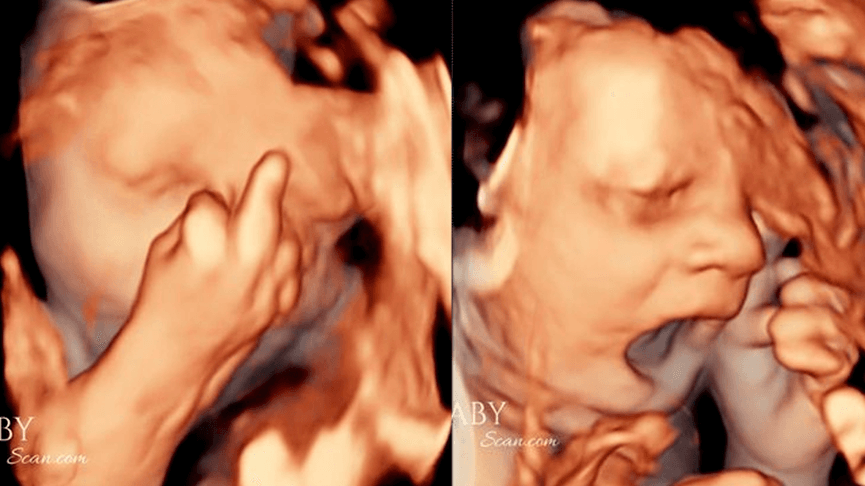 Ultrassom e bebê com o dedo do meio. (Foto: Divulgação)