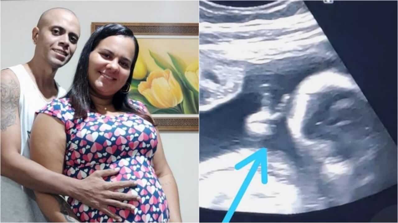 Bebê faz sinal de "V de vitória" durante ultrassom