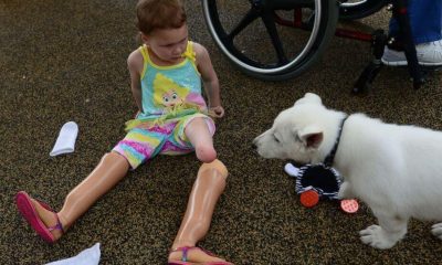 Menina com próteses nas pernas e cachorro branco