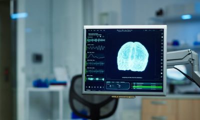 Tela de monitor com imagem de cérebro