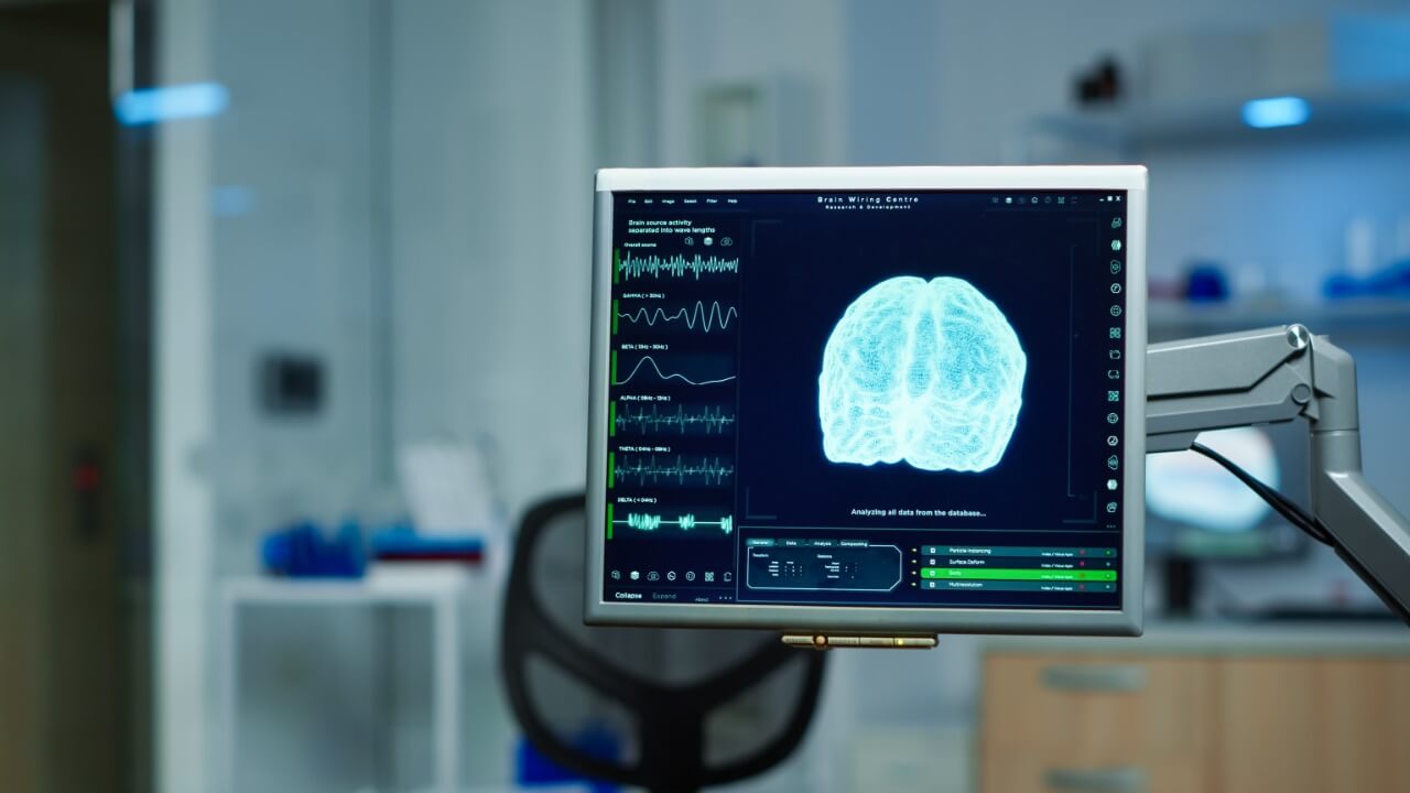 Tela de monitor com imagem de cérebro