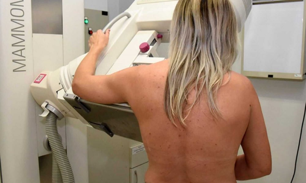 mulher realizando o exame de Mamografia