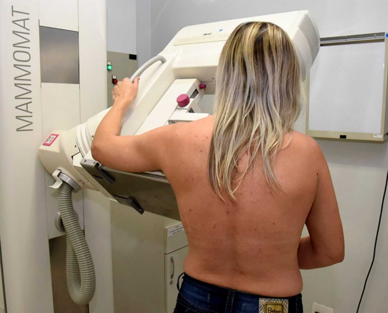 mulher realizando o exame de Mamografia