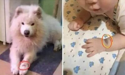 Cachorro e bebê com marcas de nascença iguais
